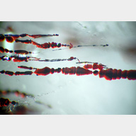 inclusions