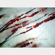 inclusions